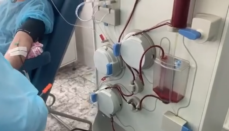 plasma-1